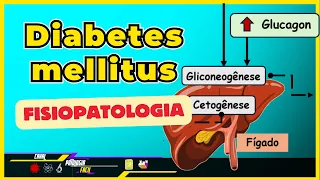 Diabetes Mellitus - Fisiopatologia; Definição; Tipos; Exames; Diagnóstico. [Patologia]