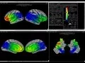 MVPA Visualization