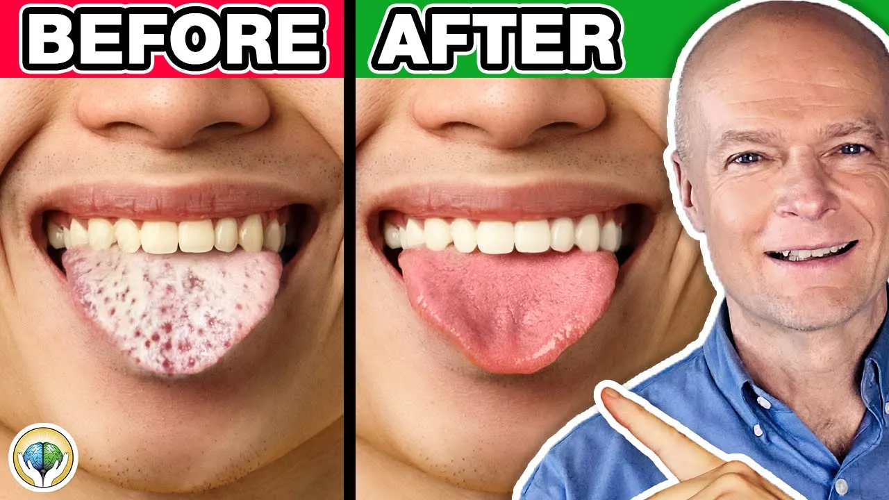 #1 Absolute Best Way To Cure Yeast & Candida Overgrowth