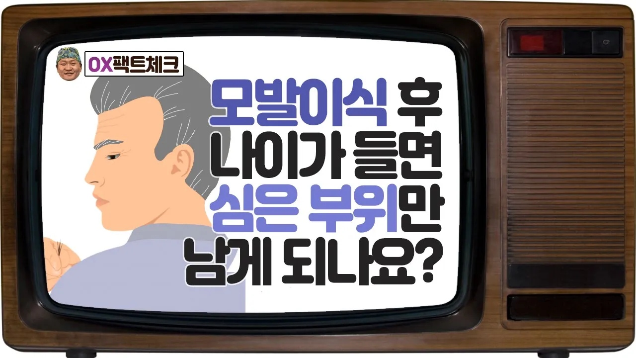 모발이식 후 나이가 들면 심은 부위만 남게되나요? [OX팩트체크 17회]