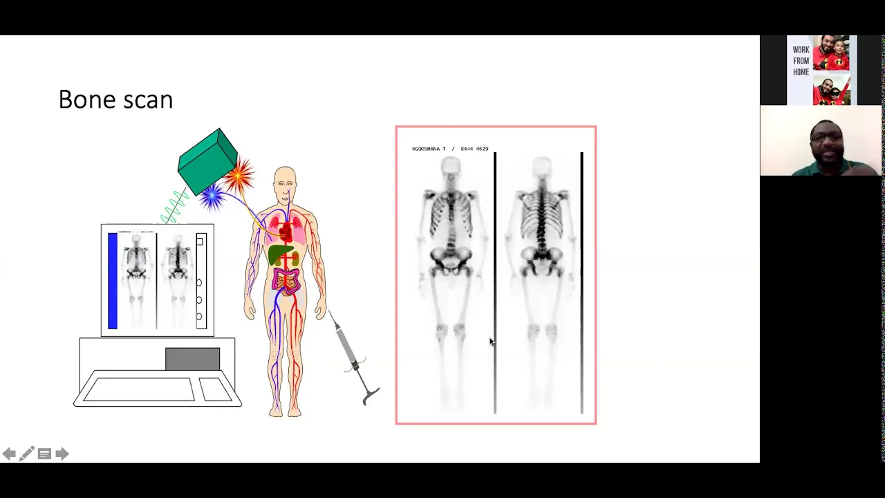 1- Nuclear bone scan by dr. Jawa