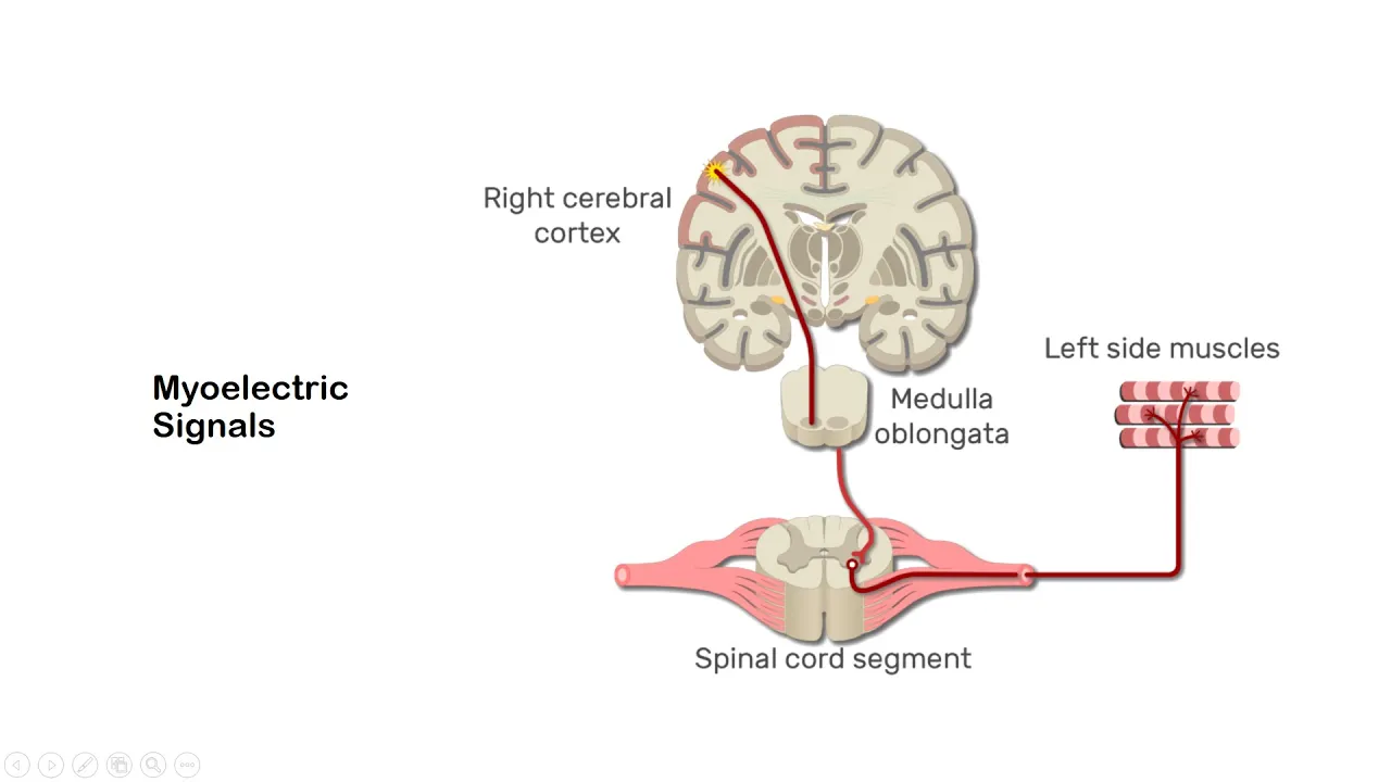 Electromyography (EMG) Explained: Signal Acquisition & Processing