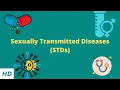 Sexually Transmitted Diseases STDs Causes Signs and Symptoms Diagnosis and Treatment