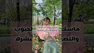 ماسك لازالة اثار الحبوب والتصبغات من البشره Fyp اشتركي يحلوه 