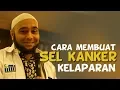Download Lagu dr ZAIDUL AKBAR - Cara Membuat Sel Kanker Kelaparan