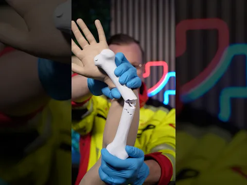 How to Splint a Broken Arm with Cardboard 📦🚑 #ambulance #paramedic #emergency #firstaid #fracture