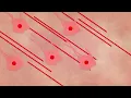 The surprising reason you feel awful when you're sick - Marco A. Sotomayor