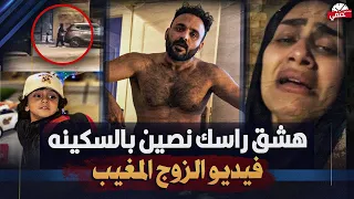 ه   شق رأسك نصين تفاصيل مرعبة في واقعة اتهام  زوج لزوجته بالخيانة     شاهد الفيديو    دندنها