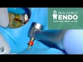 Root Canal Tips with Dr Allen Ali Naseh a RealWorld Endodontist EndosKool