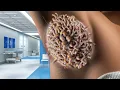 Download Lagu ASMR Jagalah Kebersihan Ketiak Anda Selalu | ASMR Khanda Treatment Animation | ASMR