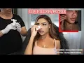VLOG Lip Injections Botox