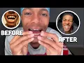 How I Fixed My Gap Part 1 Byte Review