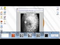 diabetic retinopathy detection using matlab code final year ece projects at bangalore
