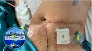 The PILL caused my LIVER CANCER