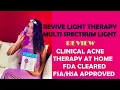 Review of Revive Multi Spectrum Light clinical home acne treatment device