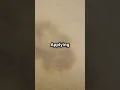 How to Heal Bruises Faster