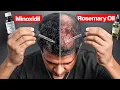 I Compared Rosemary Oil vs Minoxidil for 90 Days Winner Surprised Me