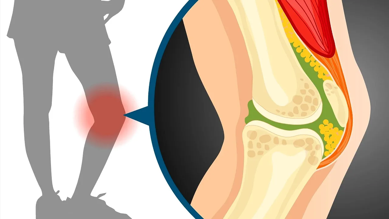Sliding filament theory in muscle contraction | Wellcome