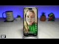 How to Detect Any Illness With AI Health Filter on Tiktok | AI Health Filter Trend Video (2023)