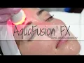 AquaFusion FX with Jessica Serfaty Rejuvenate Medical Spa in Encino CA