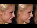 Dr Bader NOSE Hollywood episode 4 Paris Hilton