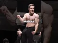 Download Lagu Rare Condition Makes Him Muscular