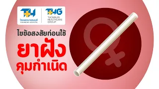 ยาฝังคุมกำเนิดคืออะไร และออกฤทธิ์อย่างไร