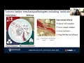 Abnormal Mechanics in Brain Tumors Implications for Immunotherapy - Dr Meenal Datta