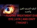 Download Lagu RUQYAH TREATMENT EVIL EYE ( AYN ) AND ENVY ( HASAD ).