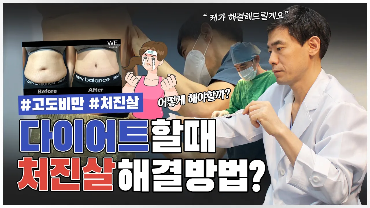 다이어트 처진 살은 어떻게 해야 될 지 모르고 불안하다면