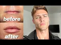 How To Get Bigger More Attractive Lips for guys