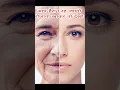 Download Lagu झुर्रियों से छुटकारा कैसे पाएं | wrinkles kaise hataye | wrinkles kaise remove Karen #shorts #viral