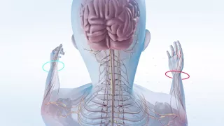 What is Multiple Sclerosis An Overview of MS Causes Symptoms Treatments Research