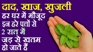 दाद खाज खुजली का घरेलू नुस्खा - Daad Khaj Khujli Ki Dawa - How To Cure Ringworm