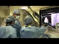 Advice for Hospitals Starting a Structural Heart Program