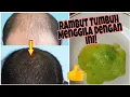 Download Lagu PENUMBUH RAMBUT SUPER CEPAT TANPA EFEK SAMPING!