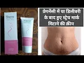 Stretch Mark Reduction Cream During and After Pregnancy Shauna Anti-Stretch Cream