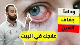 جفاف العين اسبابه و علاجه بشكل نهائي في البيت ف   خطوات   افضل قطرة ل علاج التهاب و احمرار العين دندنها