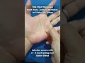 Download Lagu Gerakan/Senam Titik Pijat Mengatasi Jantung Berdebar,Nyeri Dada,Jari Kaku dan Kebas.Mari Hidup Sehat