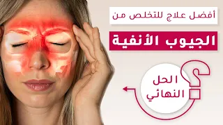 علاج التهاب الجيوب الانفية وانسداد الانف بخطوات بسيطة   الحل النهائي بدون أدوية دندنها