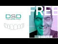 Digital Smile Design DSD intro