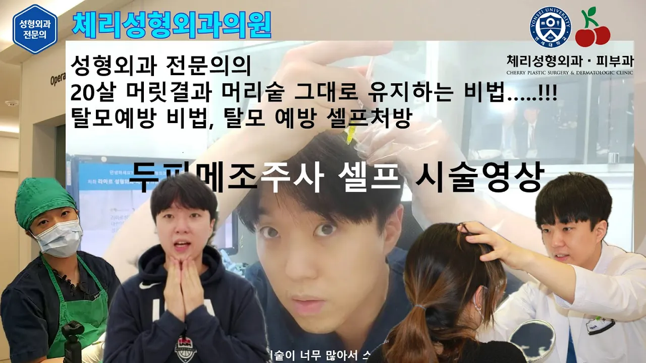 [체리성형외과의원 ]대표원장님 셀프시술 제2편! : 탈모극복 두피메조 셀프시술 영상