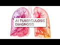 Can Artificial Intelligence Detect Tuberculosis