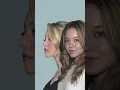 Sydney Sweeney s Plastic Surgeries Transformations Before After