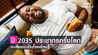 โรคอ้วนเกิดจากอะไรบ้าง