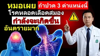 การตรวจวินิจฉัยโรคหลอดเลือดสมองในระยะเริ่มต้น มักใช้วิธีใดบ้าง