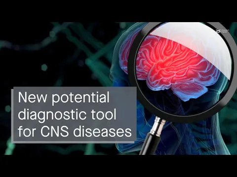 Download MP3 Novel detection system for prognosis of CNS diseases: unveiling the EV Neuro assay