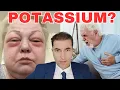 Download Lagu Koji su simptomi NEDOSTATKA KALIJA?