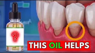 2 Drops Of This Oil  Regrow Receding Gums Fast