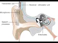 Mastoidectomy reconstruction CPT code - simplify medical coding